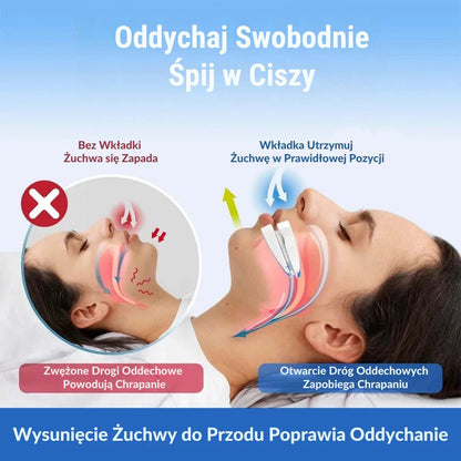 SleepCare® - Wkładka Doustna Przeciw Chrapaniu - VitaCare - 